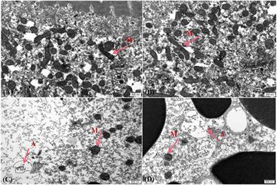 Biomarker Responses, Gene Expression Alterations, and Histological Changes in Zebrafish (Danio rerio) After In Vivo Exposure to Polychlorinated Diphenyl Ethers